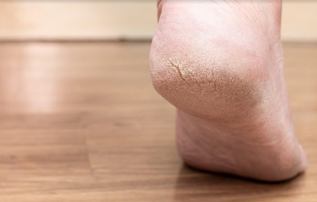 13 Common Foot Problems And How To Manage Them 2021