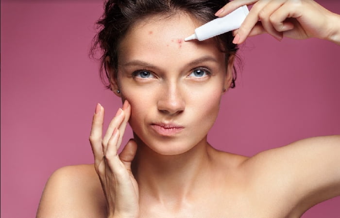 Choose The Right Acne Treatment For Your Skin